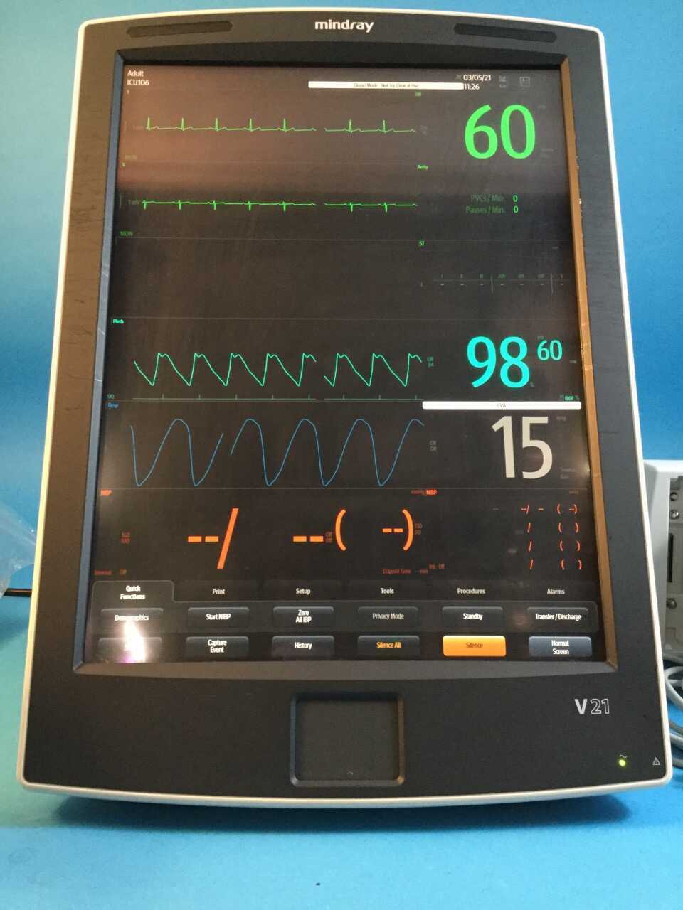 A photo of a bedside patient monitor in use at a medical surgical